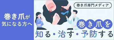 巻き爪が気になる方へ 巻き爪を知る・治す・予防する